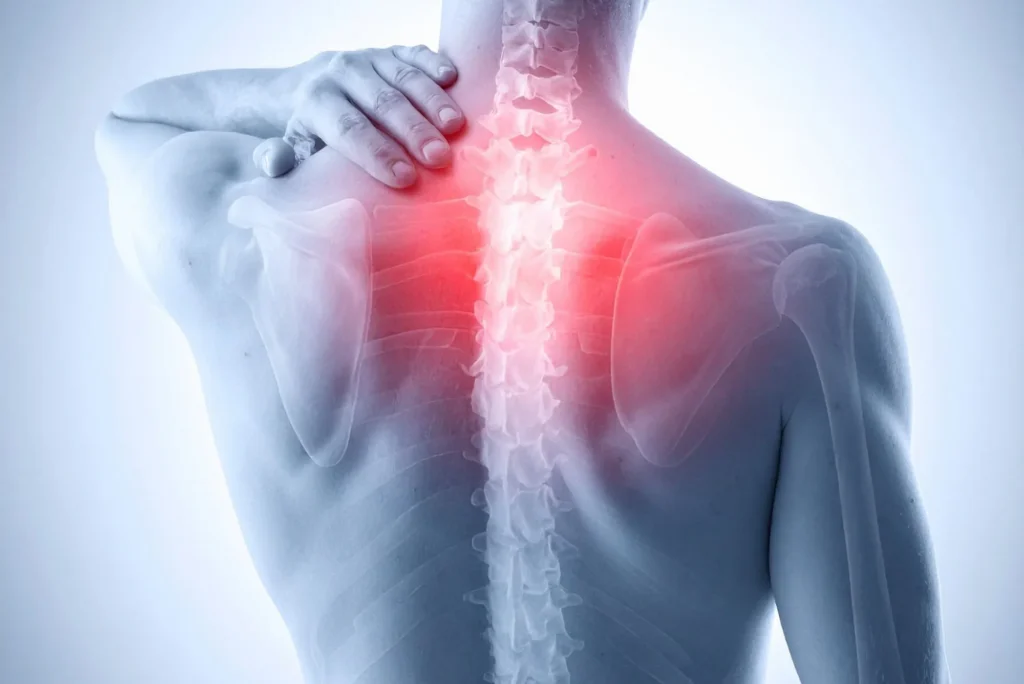 Consejos para aliviar dolor post cirugía de columna