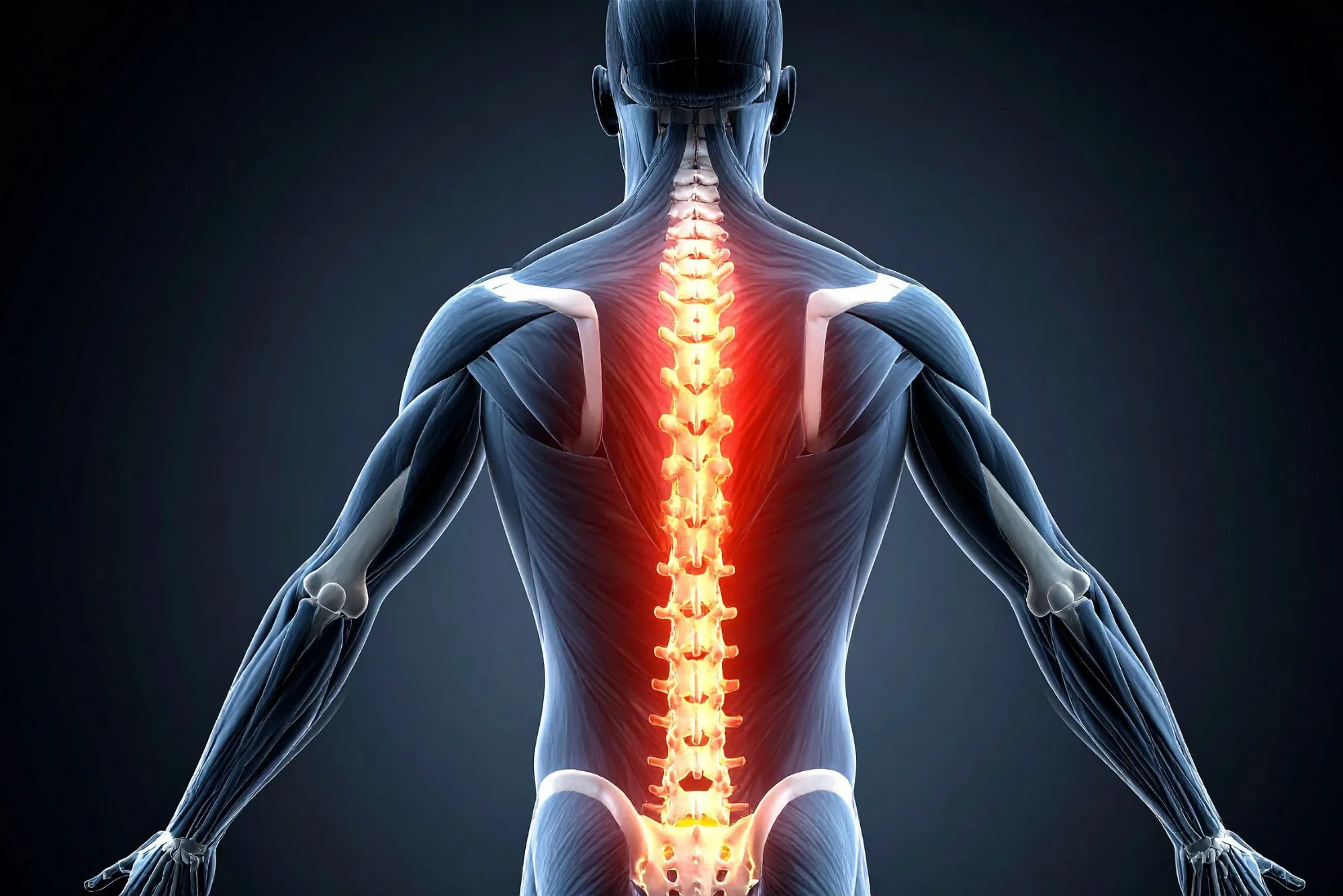 Estrategias para prevenir rigidez tras cirugía de columna